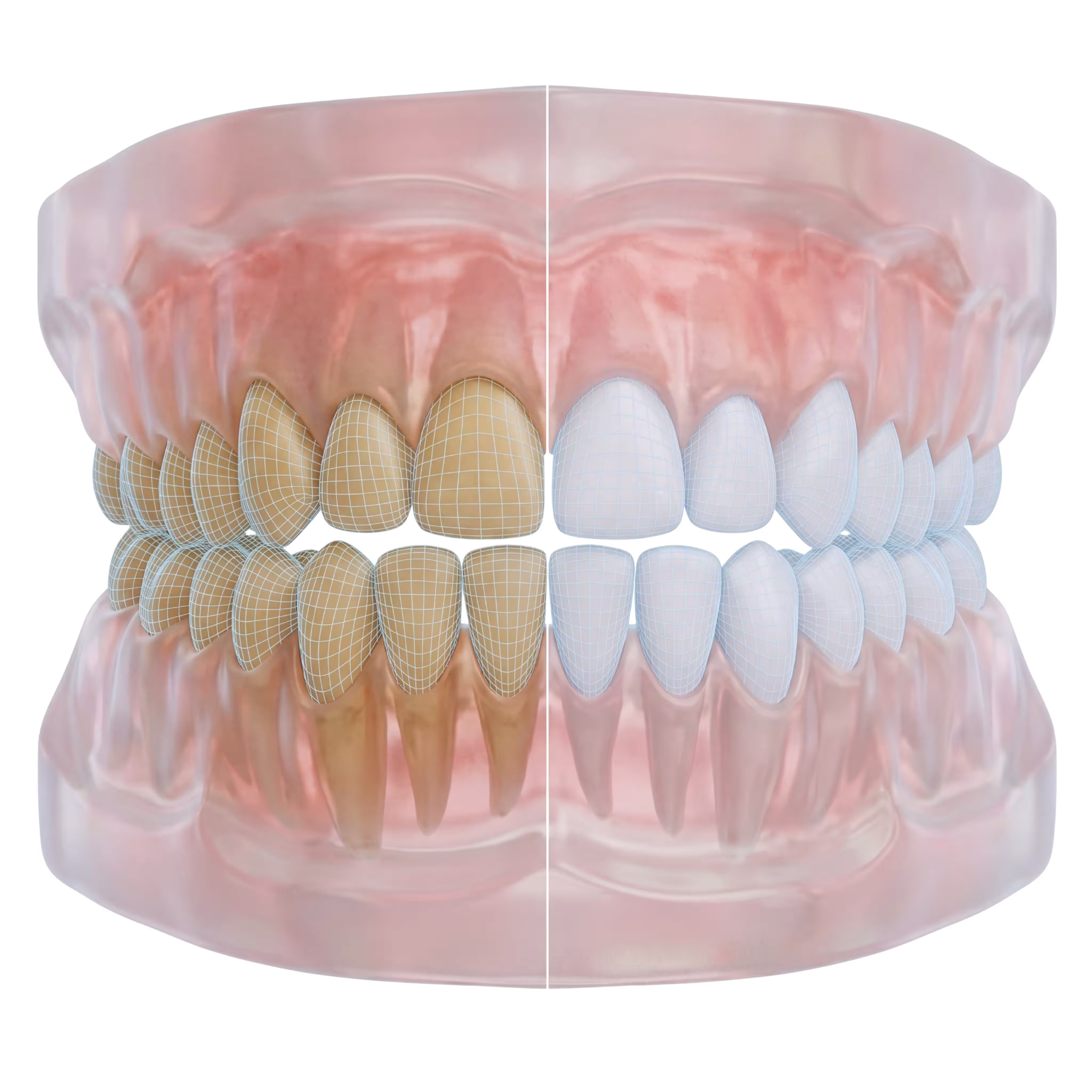 3D dental model showing teeth before and after whitening with a dividing line in the center.