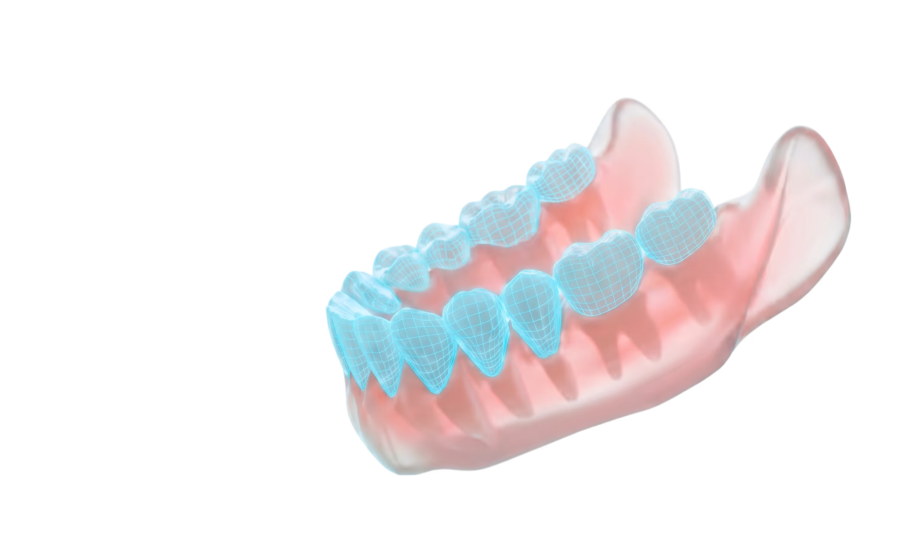 Digital model of lower jaw showing jawbone and teeth highlighted with a blue wireframe overlay.