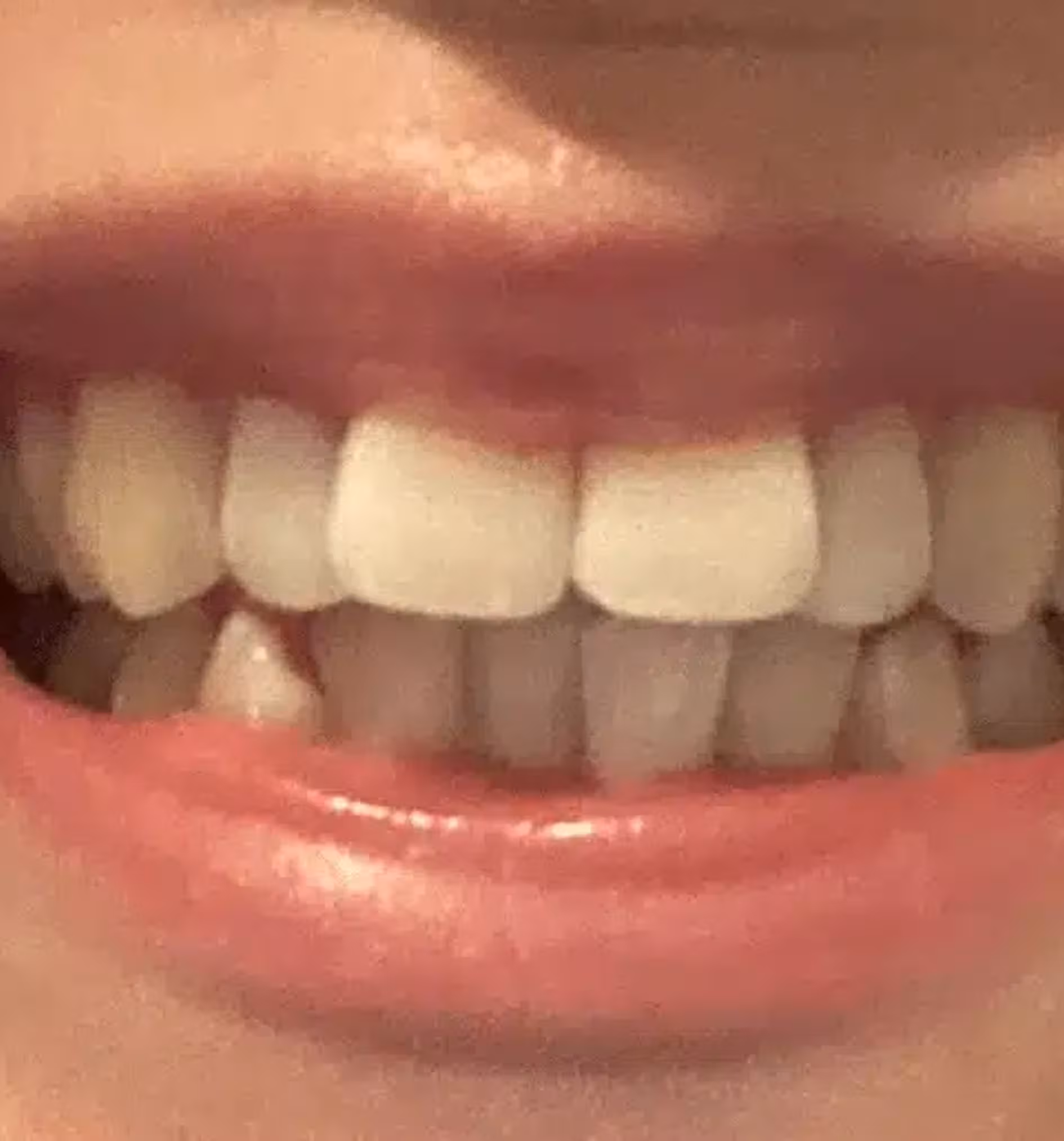 Close-up of a smiling mouth showing uneven teeth with a missing tooth on the lower row.