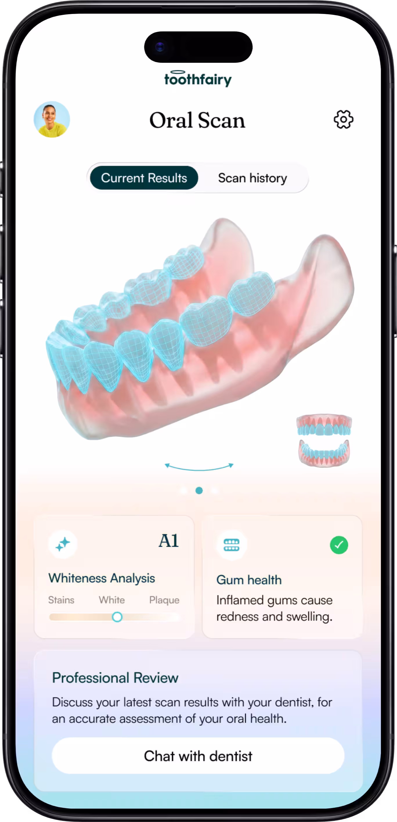 Toothfairy app screen showing 3D oral scan with whiteness analysis and gum health info.
