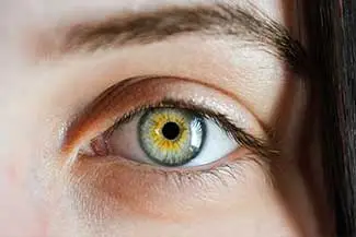 Precision scleral lens fitting for high prescriptions at Toronto Vision Therapy and Optometry