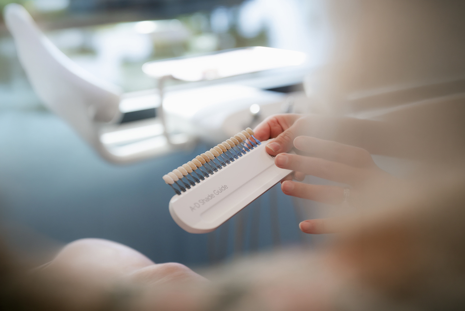 Hand holding a dental shade guide with various tooth color samples in a clinic setting.