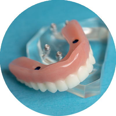 snap on denture on teal counter