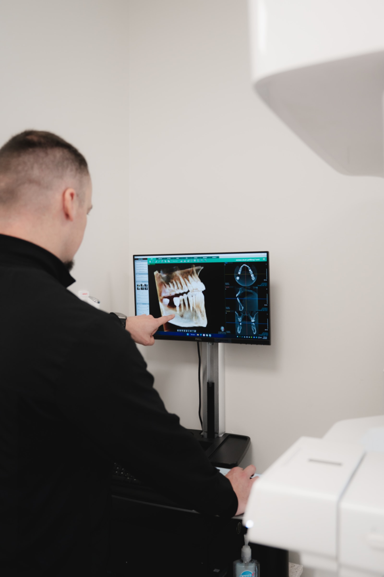 Dentist reviewing digital scan on monitor during TeethXPress implant consultation in Cape Coral office.