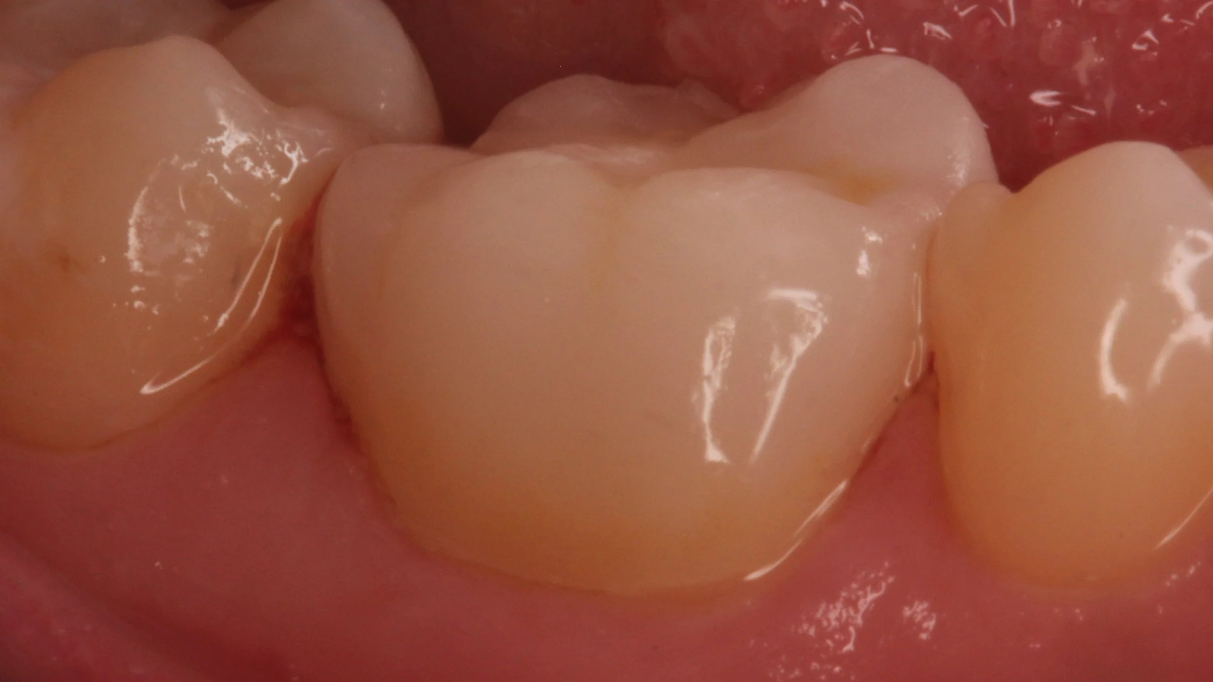 After Image