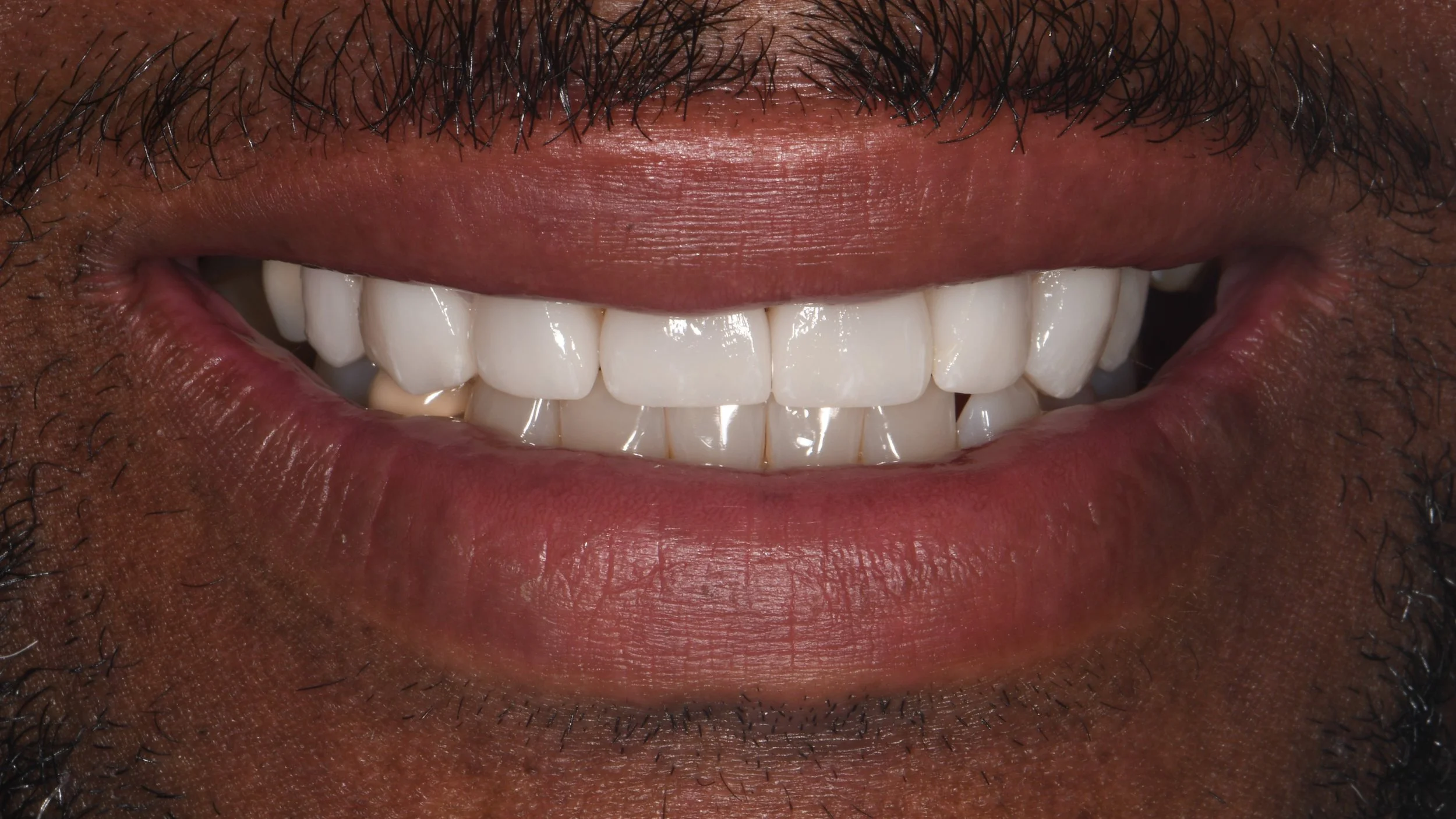 After Image