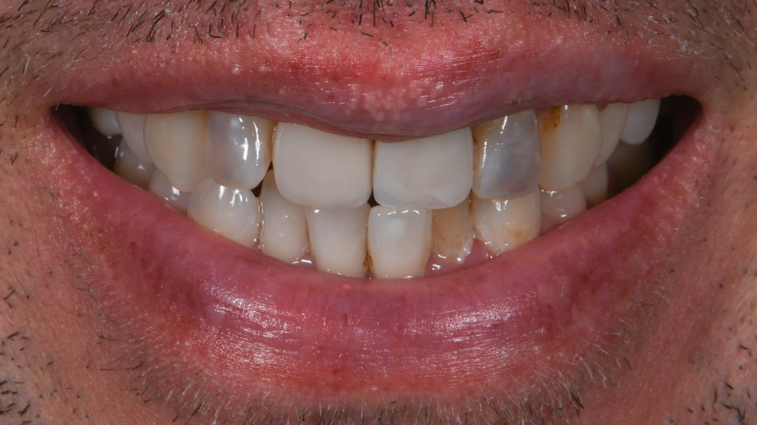 Before Image