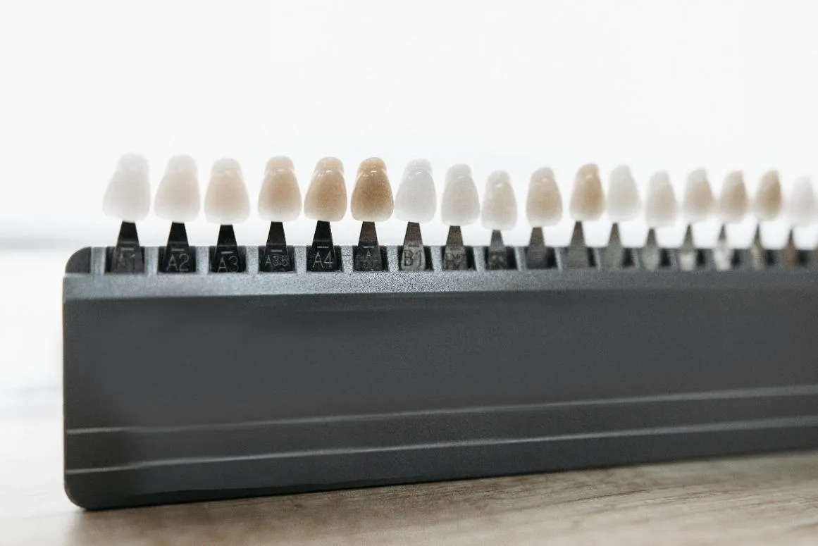 dental-veneers-point-loma-san-diego-ca
