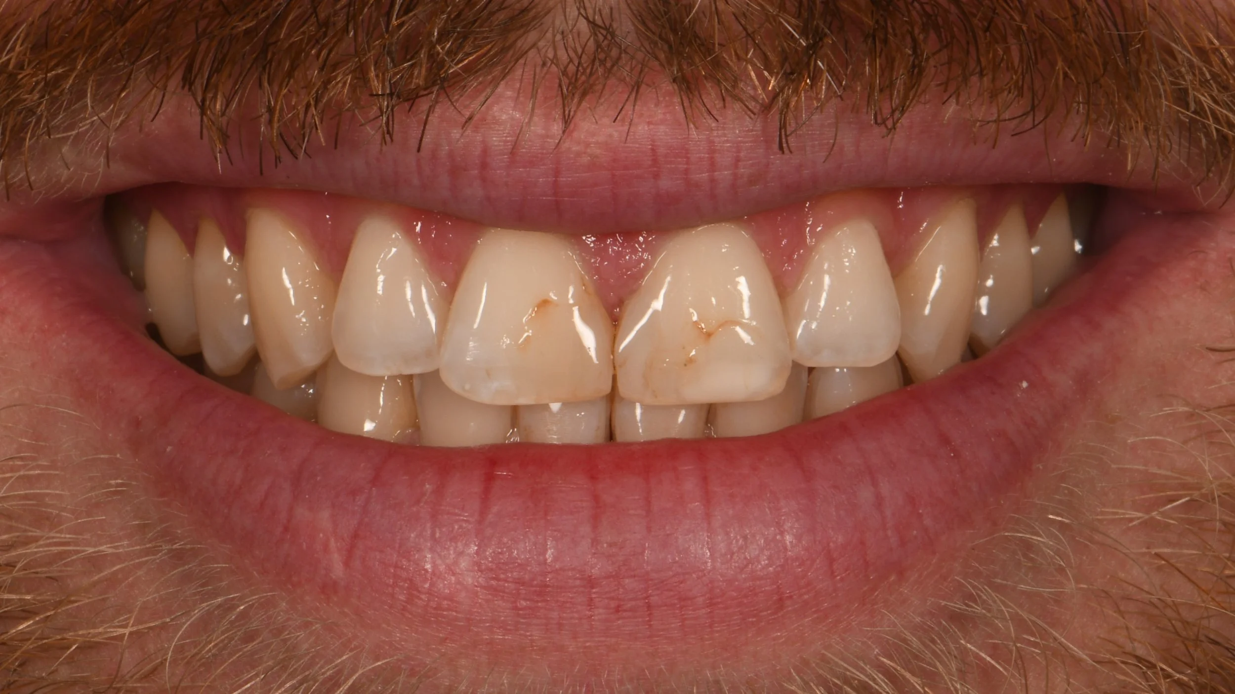 Before Image