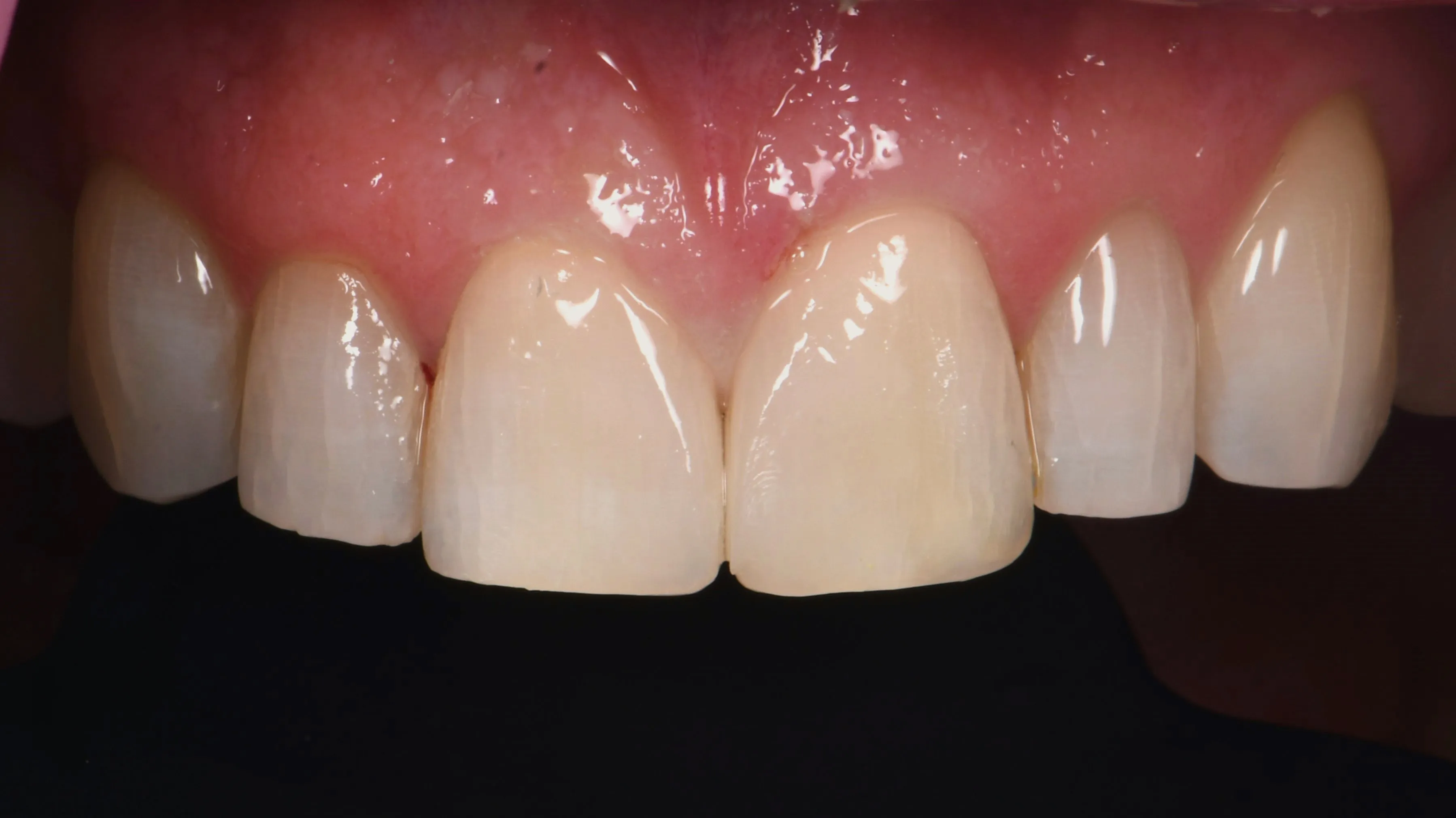 After Image