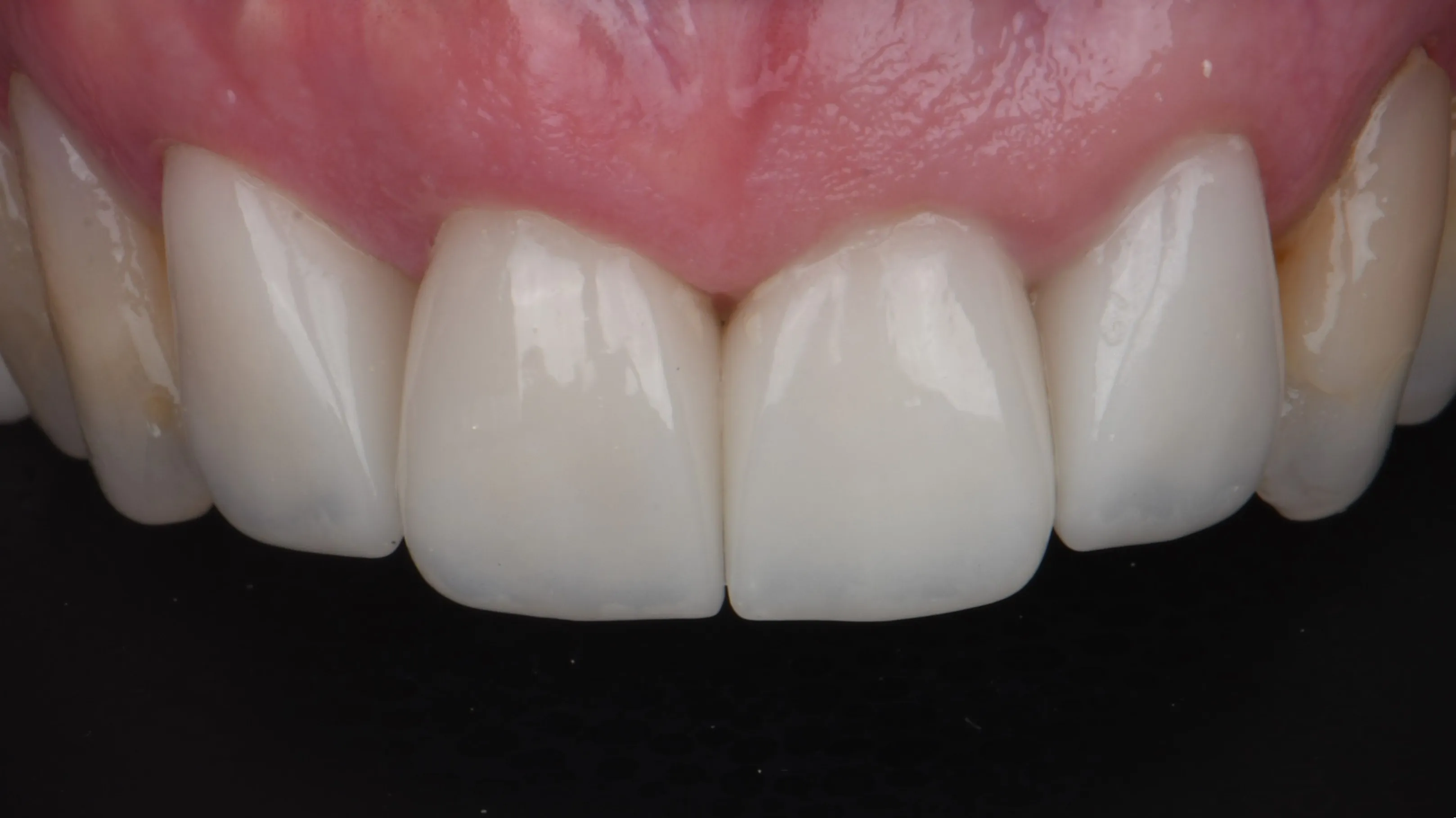 After Image