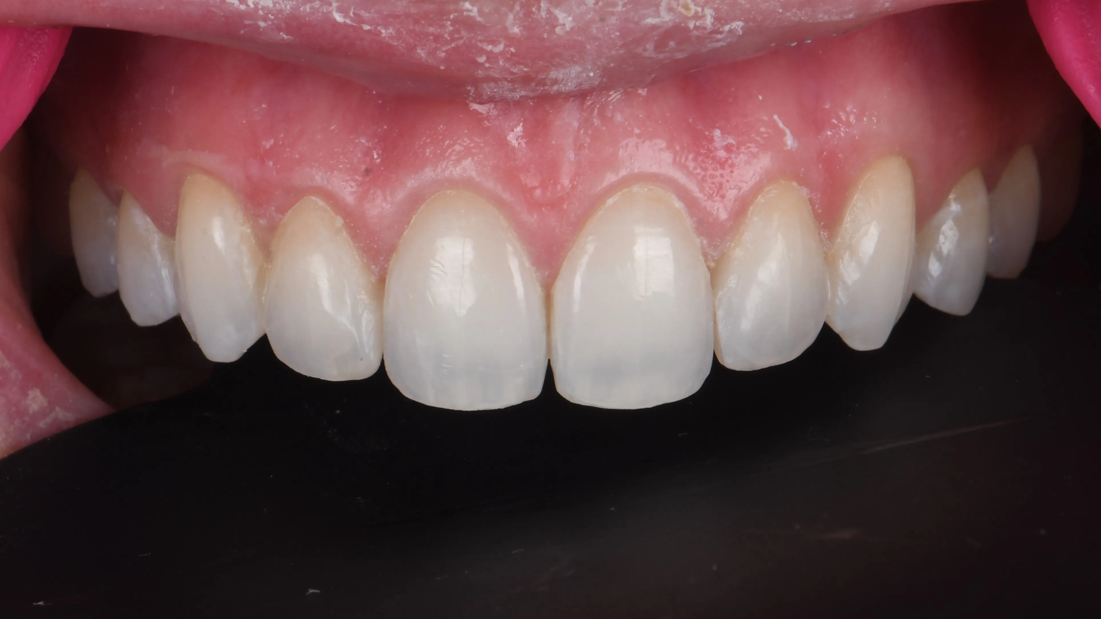 After Image