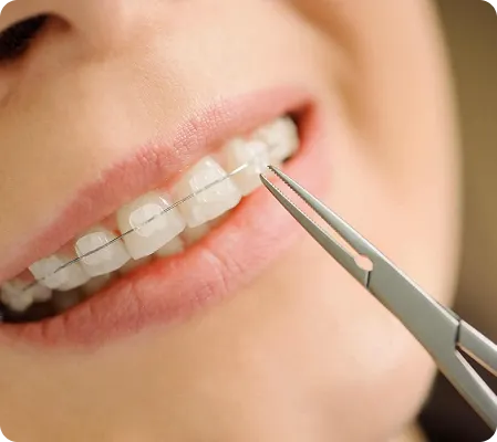 A close up of a person cutting a tooth with a pair of scissors.