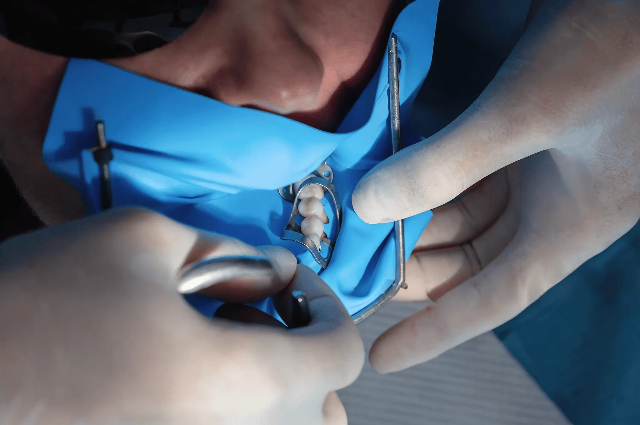 Orthodontist working with dental equipment
