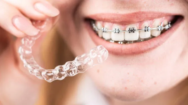 Person with metal braces holding a clear aligner