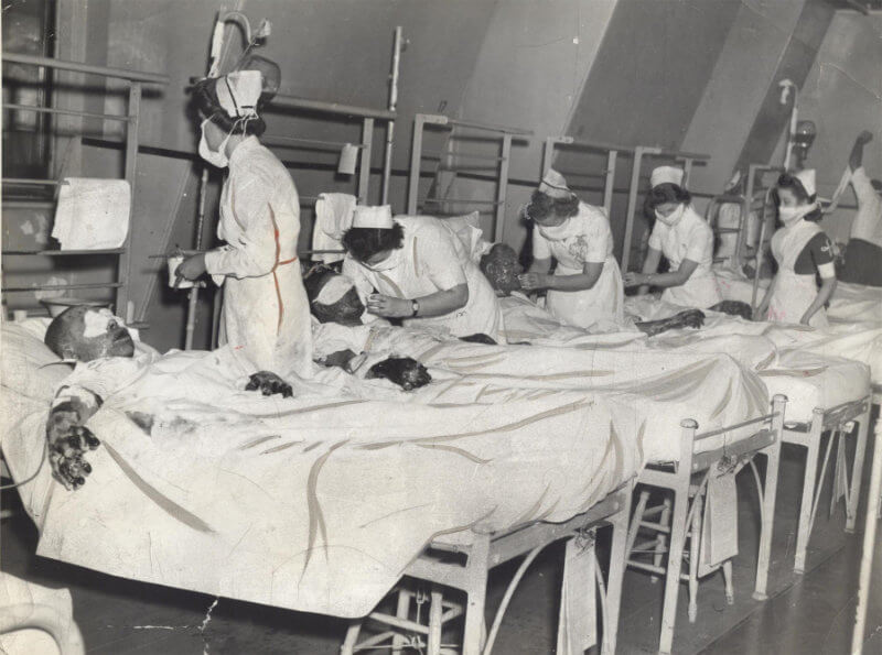 Hospital picture featuring burn victims