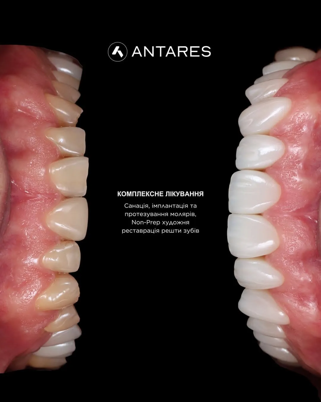 Antares Dental Instagram