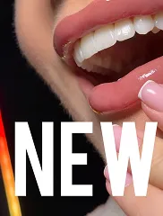 Antares Dental Instagram