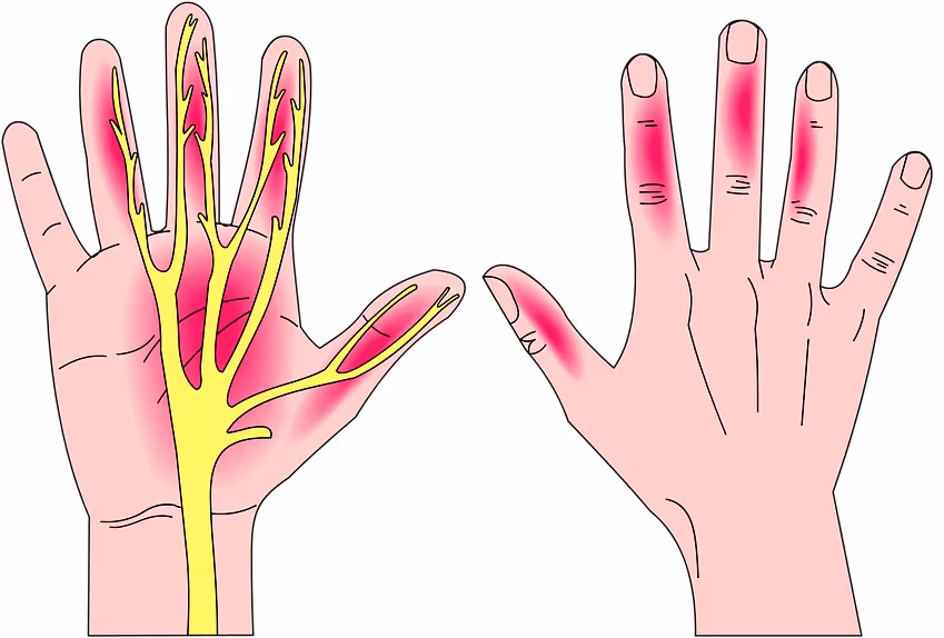 Position of the hands, wrists and keyboard while typing