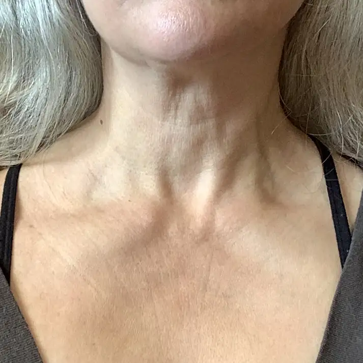 Close-up of an adult woman's neck and upper chest showing natural skin texture and wrinkles, with gray hair visible on the sides and black bra straps under a brown top.