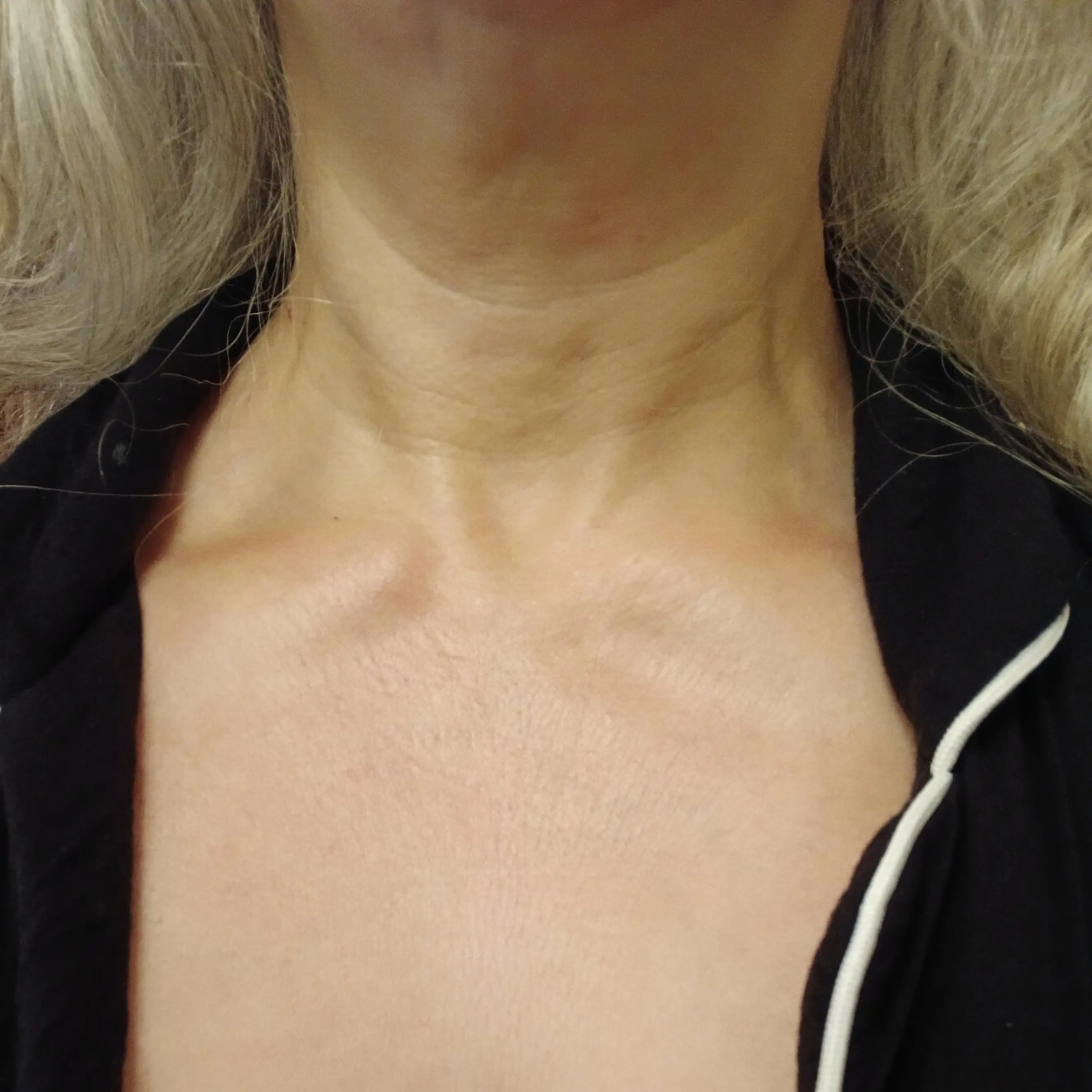 Close-up of a woman's neck and upper chest, showing skin texture and collarbones, with long blonde hair and a black garment with white trim.