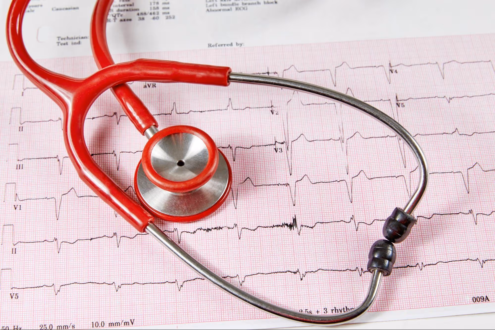 Red stethoscope resting on an ECG heart rhythm graph printout on pink paper.