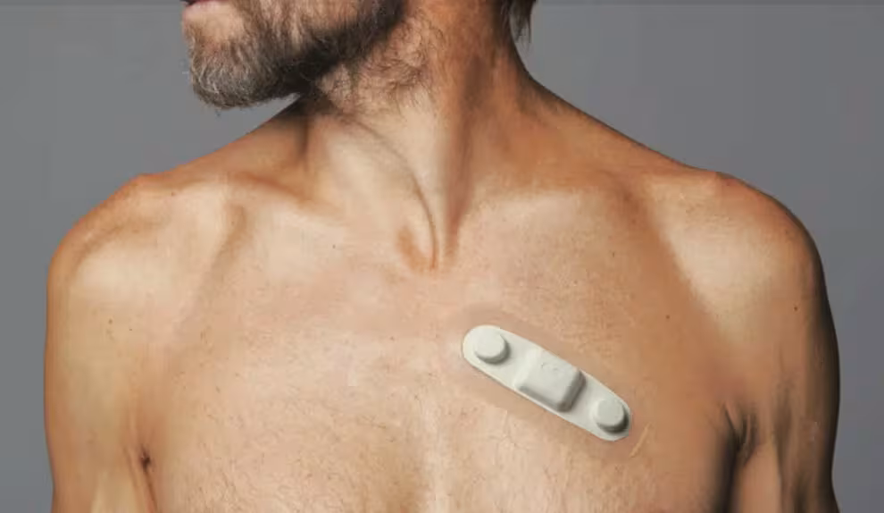 MCT Monitor Overview: Mobile Cardiac Telemetry Explained