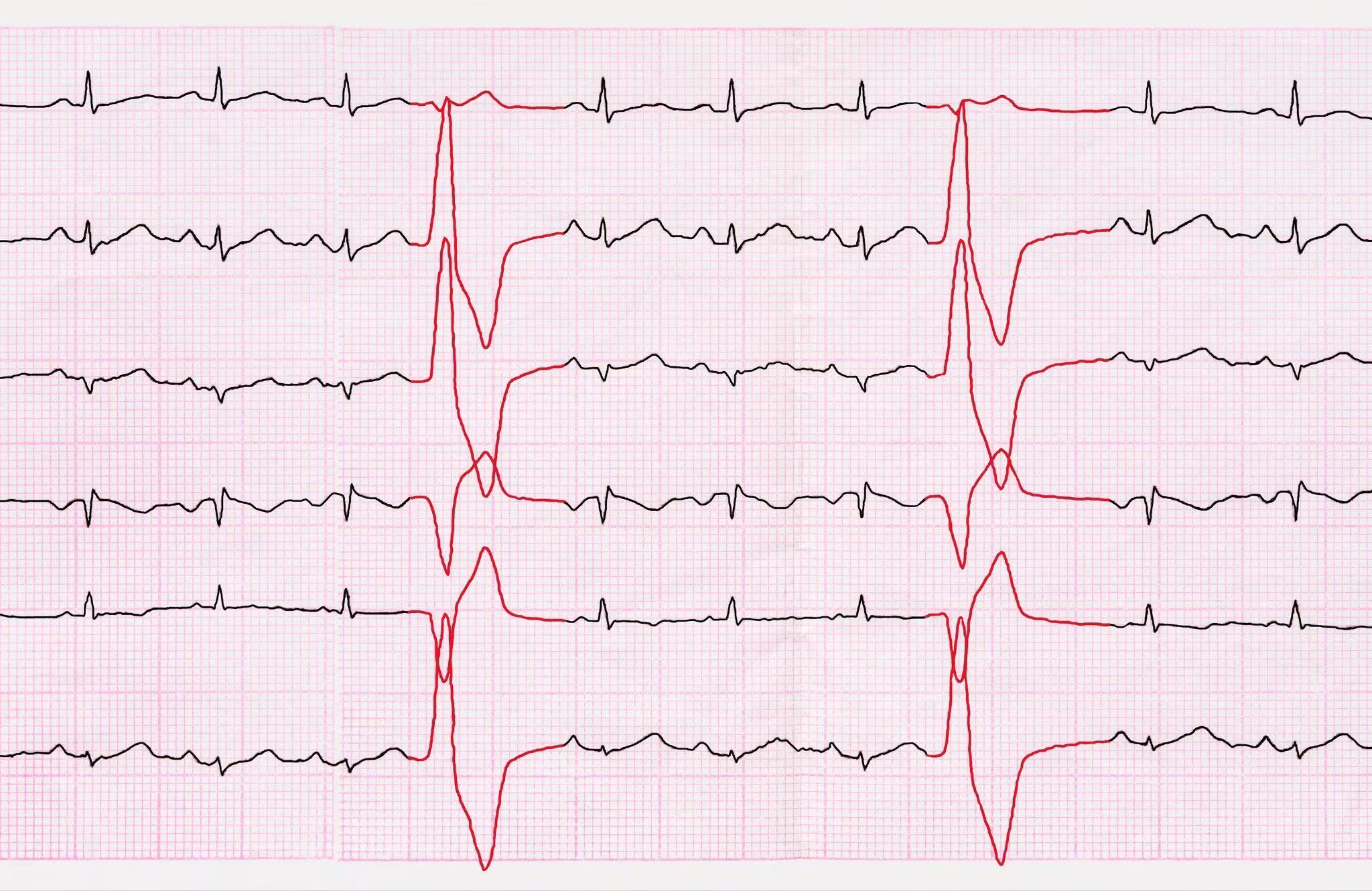 heart rate monitoring