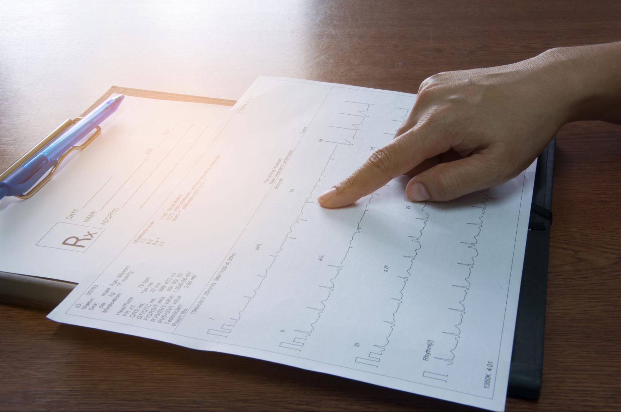 A hand points to a printed 12-lead ECG report on a clipboard, alongside a prescription pad and pen on a wooden desk.