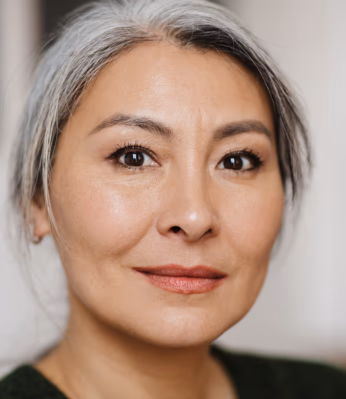 Face Lift at Stella Plastic Surgery