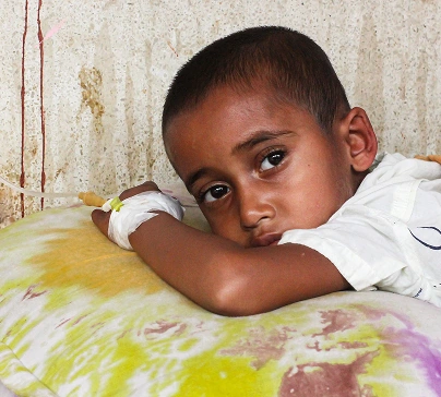 Young child receiving nutrition rehabilitation treatment with IV drip in Yemen