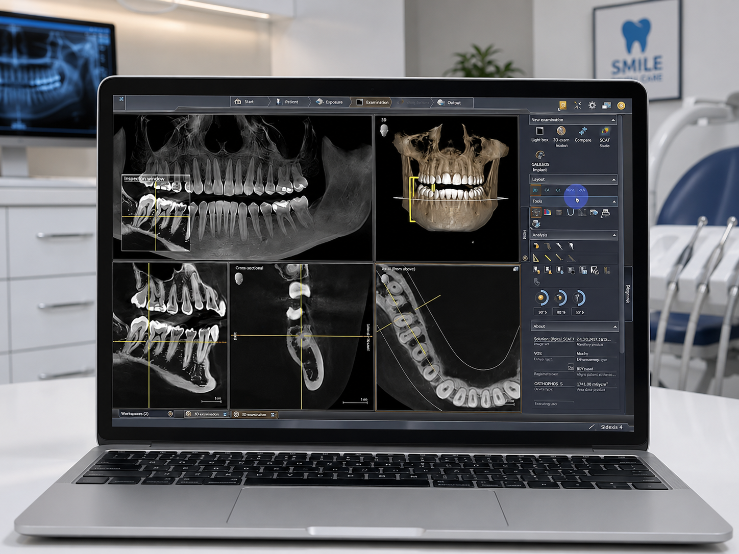CBCT Scan 2