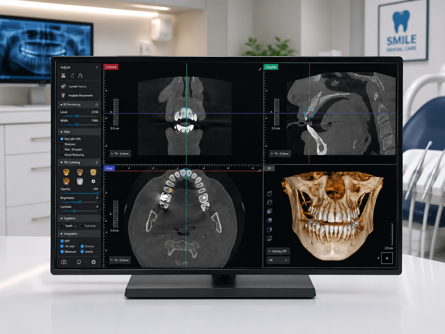 CBCT Scan 3