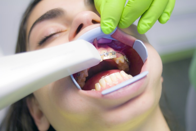 Intraoral Scanning 1