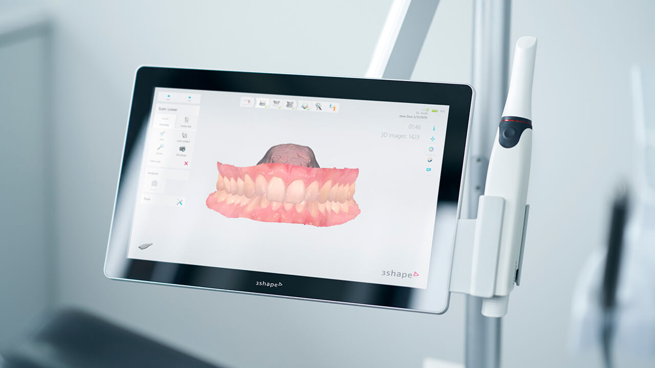 Intraoral Scanning 2