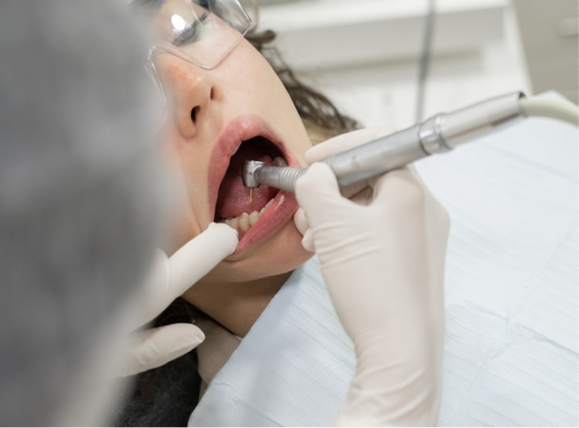 Why Regular Dental Checkups Matter