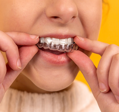 Invisalign