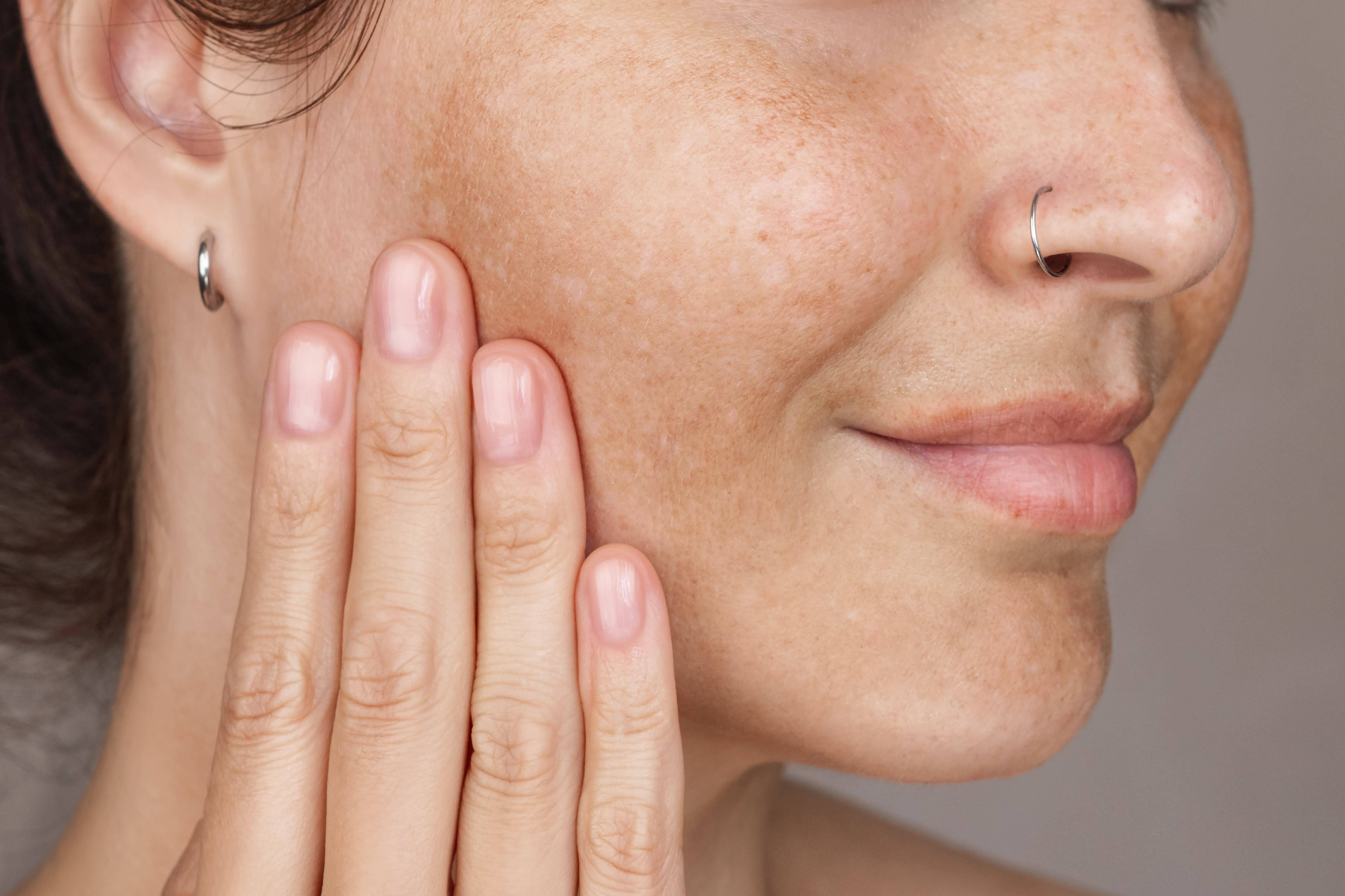 Photofacial