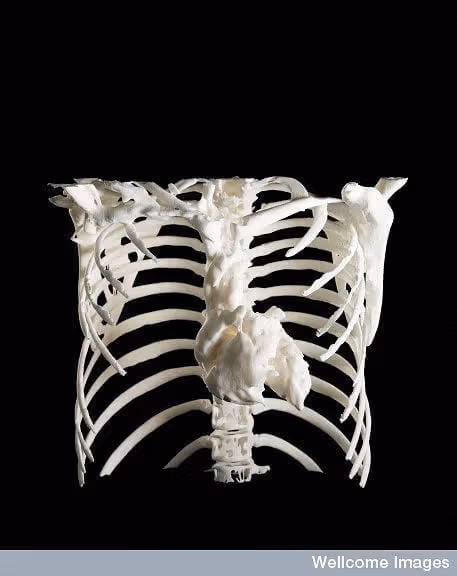3D model of the heart and rib cage