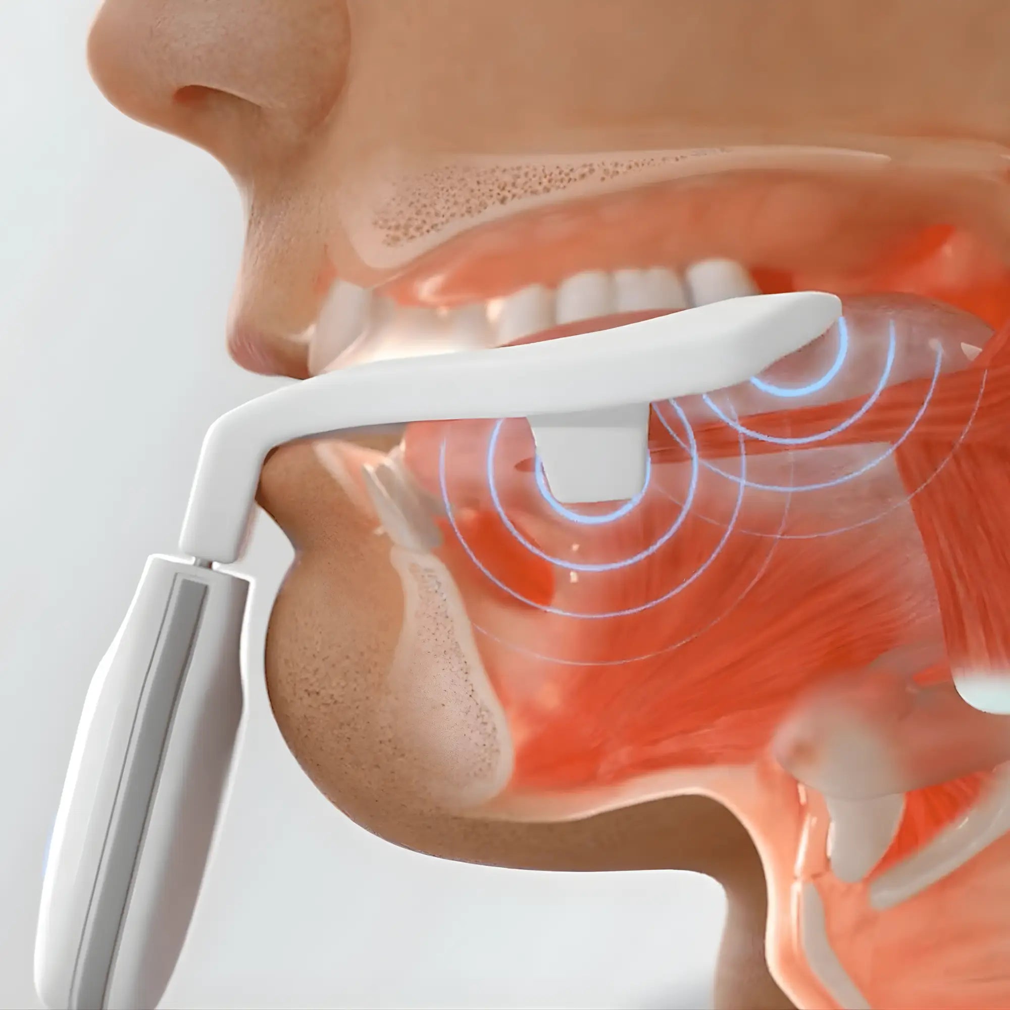 How eXciteOSA stimulates the tongue and airway muscles