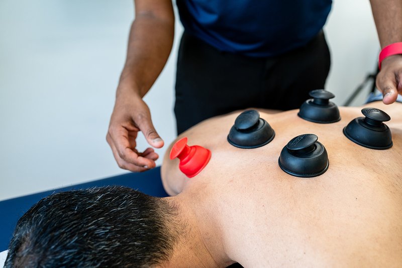 Person receiving cupping therapy with black and red cups on their back.