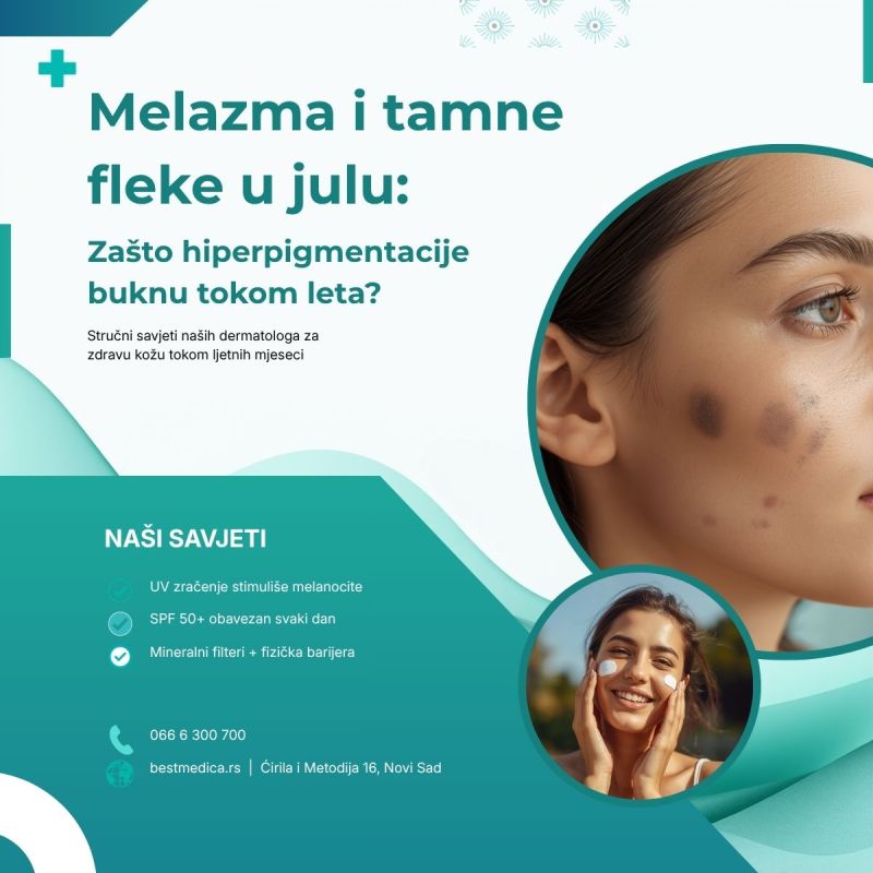 Tamne fleke na licu leti? Saznajte šta izaziva melazmu, kako je sprečiti i kako je lečiti. Saveti dermatologa iz Best Medica Poliklinike, Novi Sad.