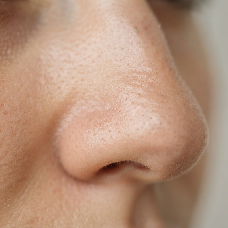 Can You Actually Shrink Pores? The Science
