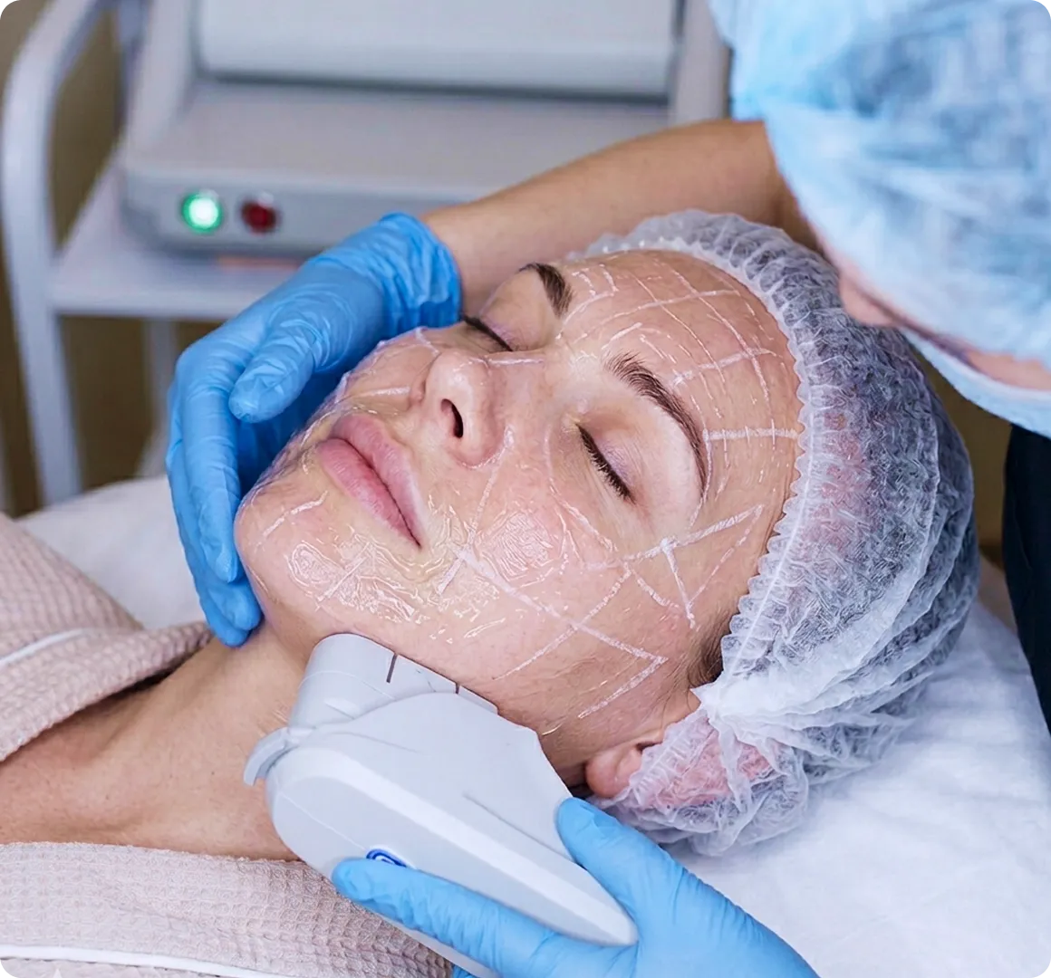 Woman receiving a facial treatment with skin markings while a technician uses a device on her jawline.
