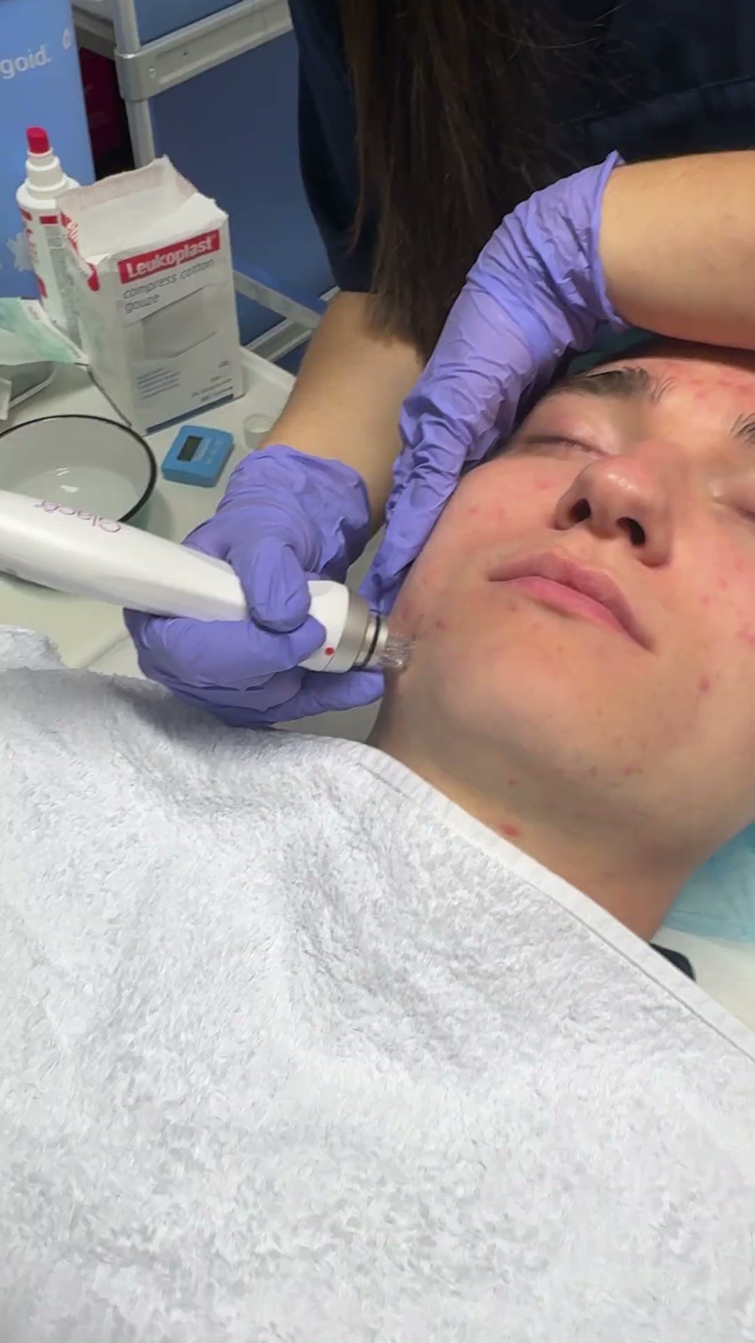 Glacē™ Gerät und Hydrodermabrasion-Technologie.