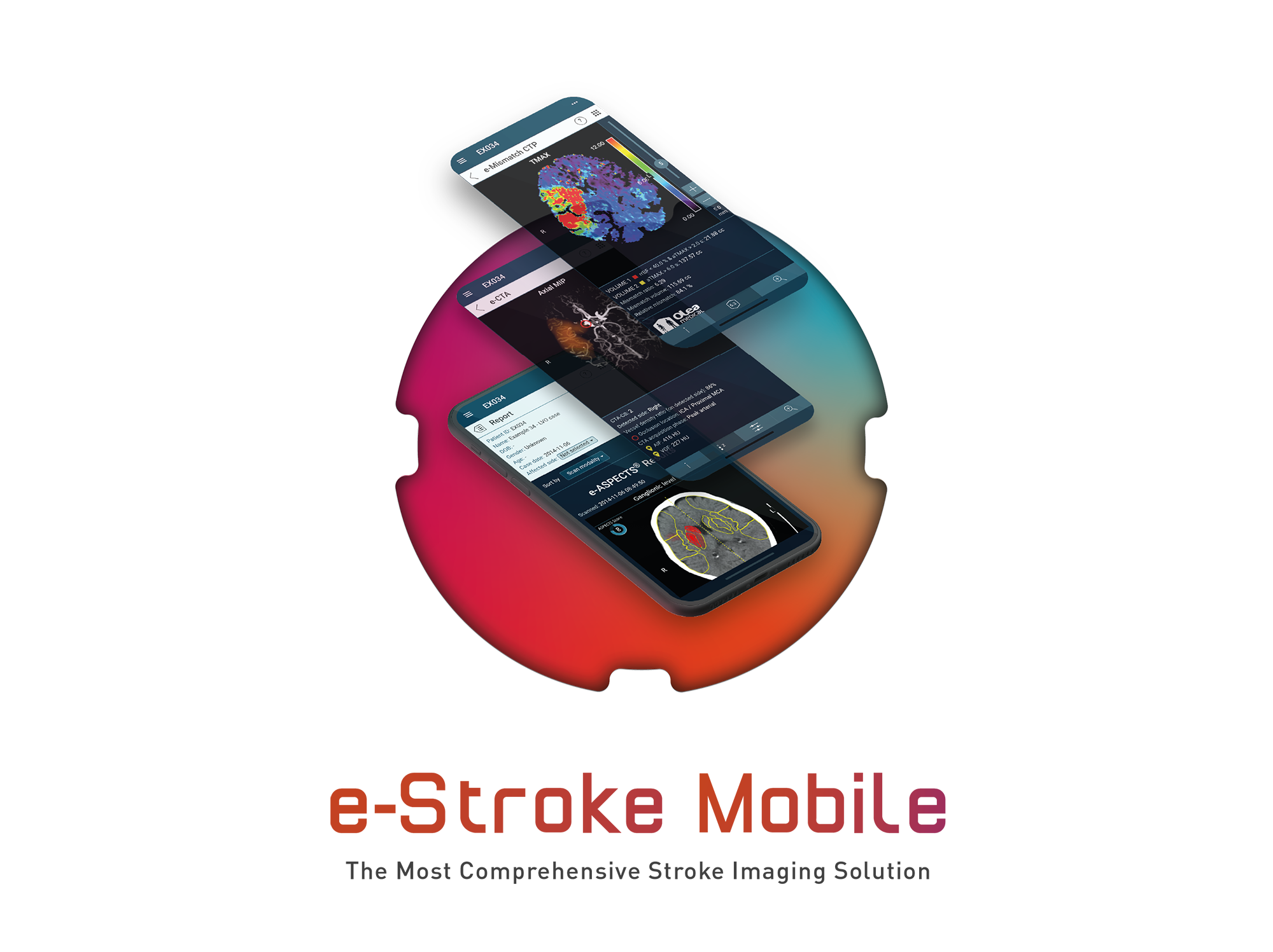 e-Stroke Suite Mobile