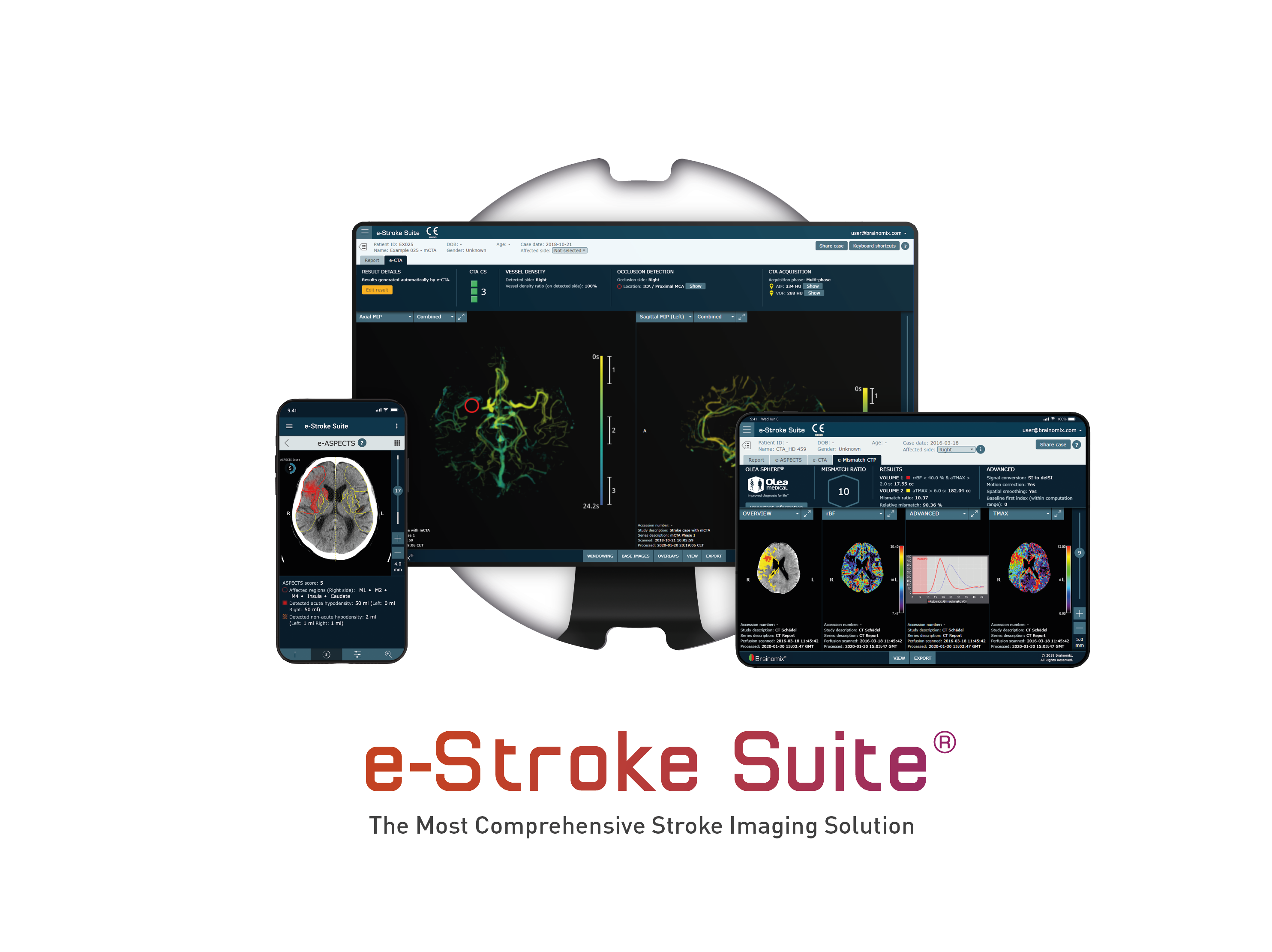 e-Stroke Suite