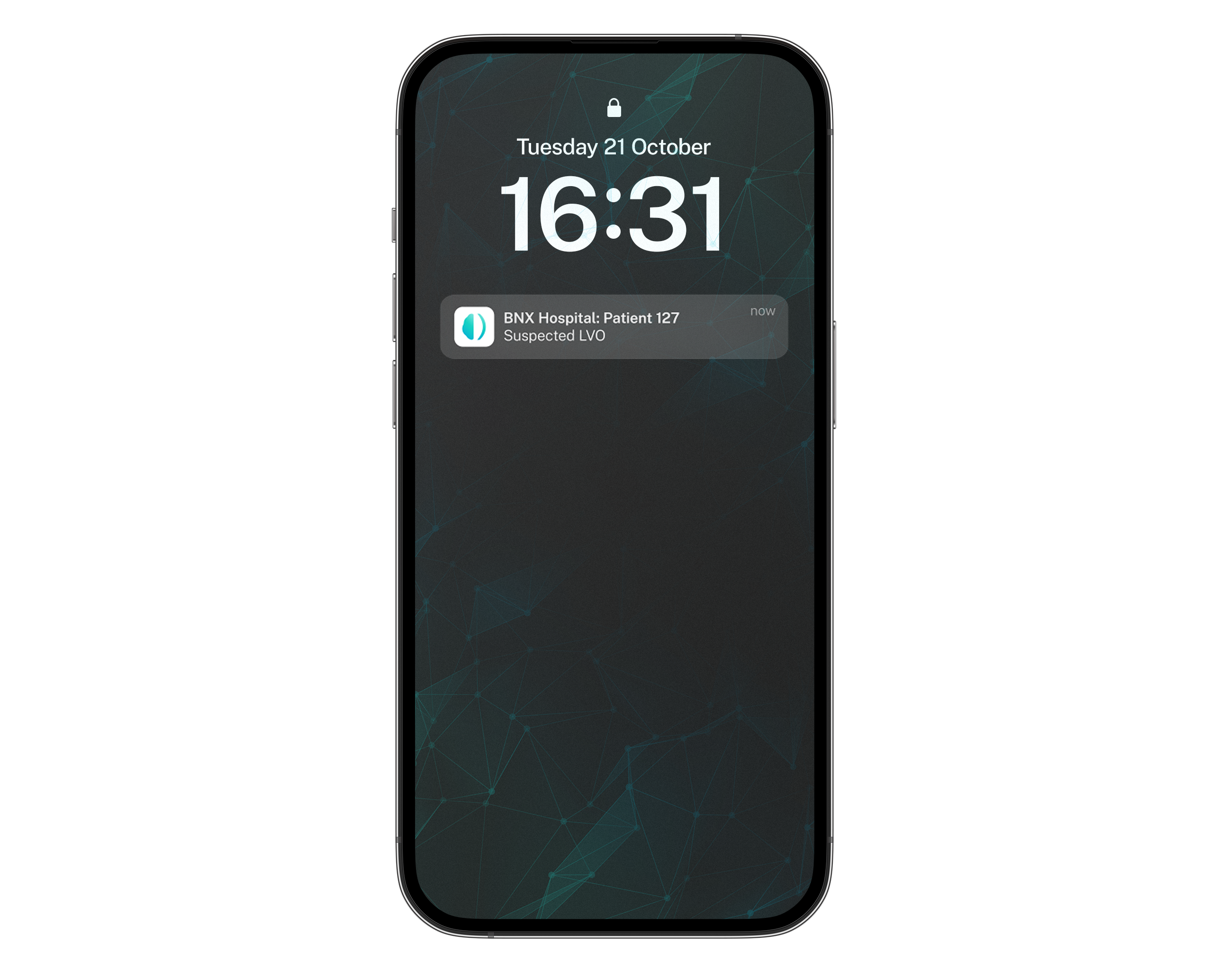 Triage LVO phone alert