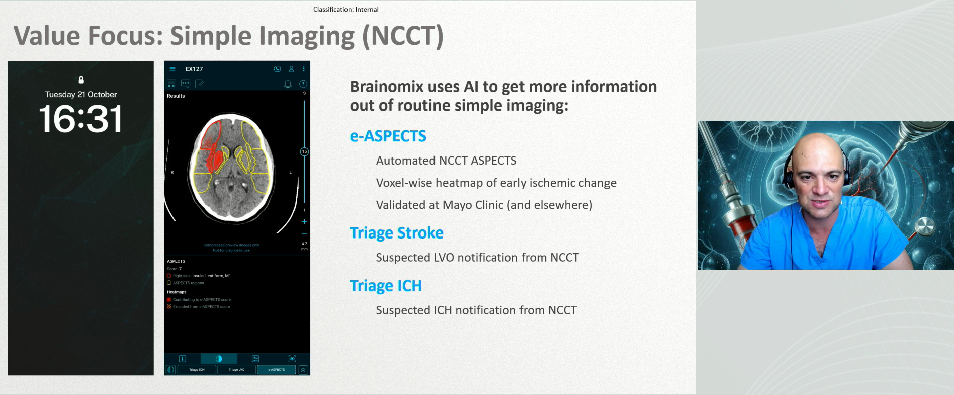 Brainomix Virtual KOL Event Screenshot