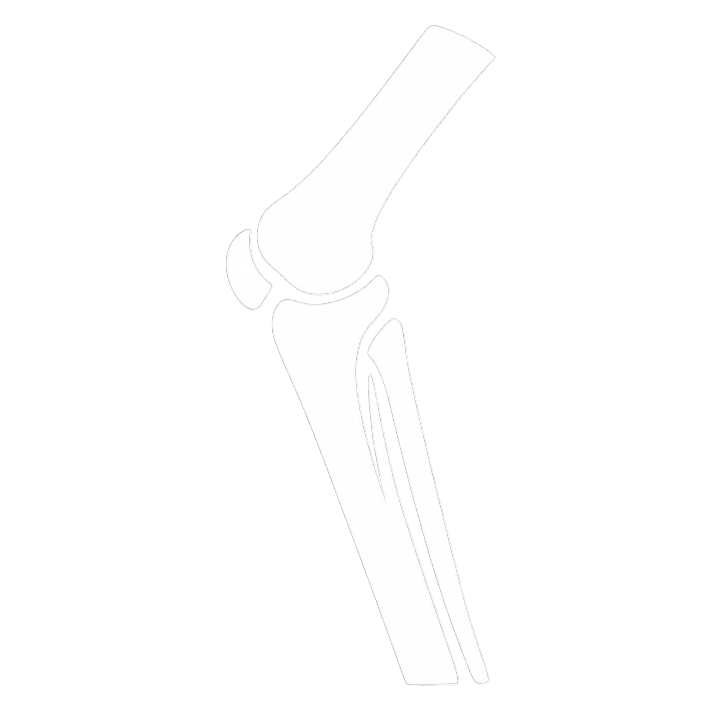 Diagram of a human knee joint showing femur, patella, tibia, and fibula bones.